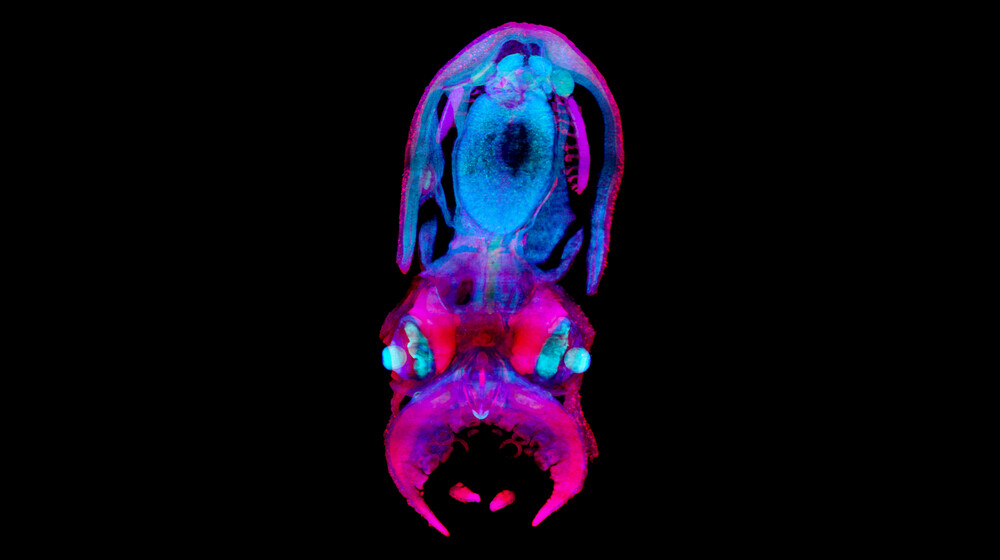 Pink and blue dominate a blurry image against a black background that is actually a global image of a 30-day-old Octopus vulgaris