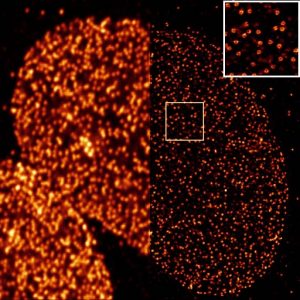Stimulated Emission Depletion (STED) Microscopy – EMBL Imaging Centre