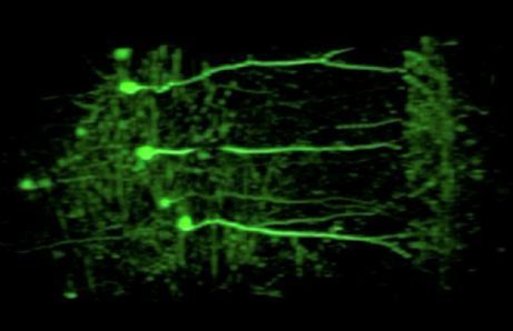 Credit: Robert Prevedel/EMBL.