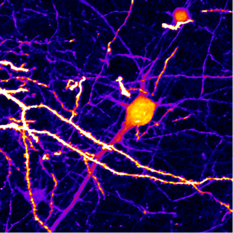 Credit: Robert Prevedel/EMBL.