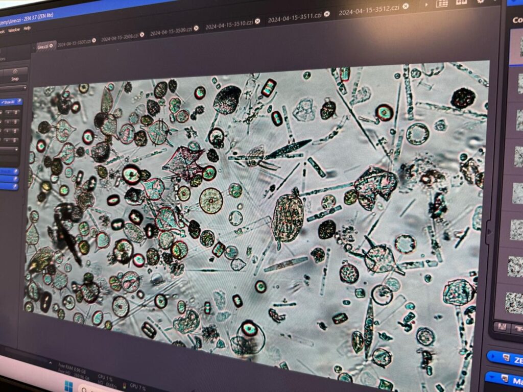 microscopy images of plankton found in a sample, organisms are of many different shapes and sizes and look almost as if from an alien world!