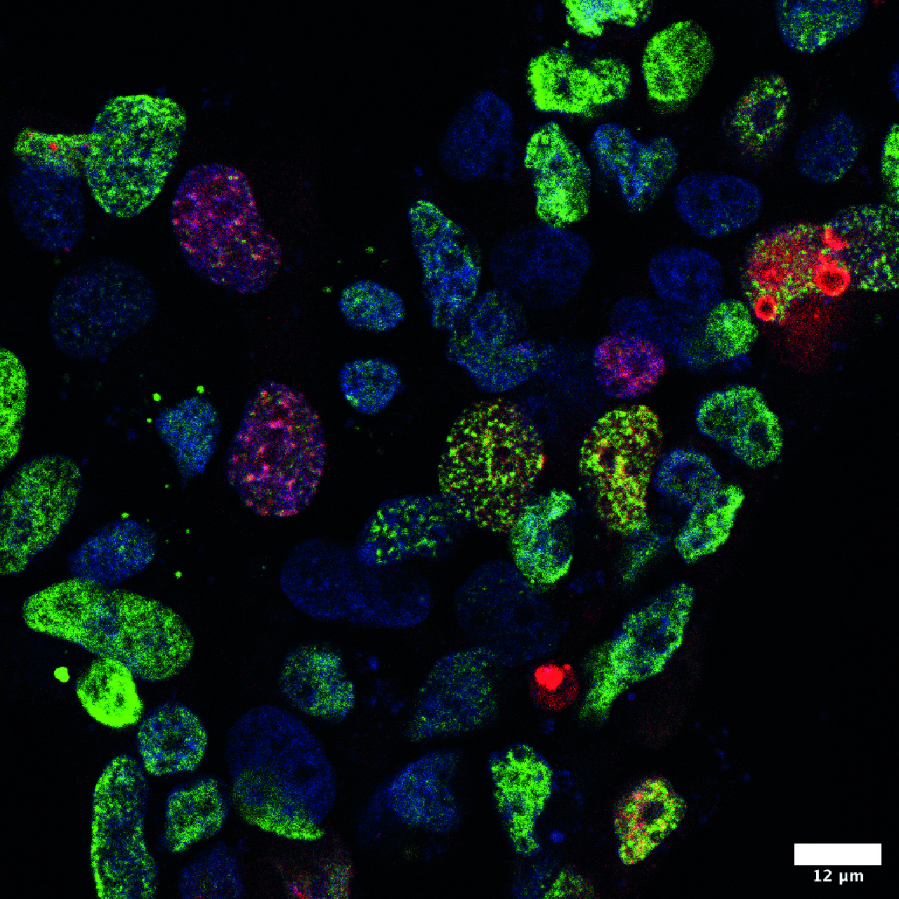 Bhogaraju Group – Structural biology of ubiquitin signalling