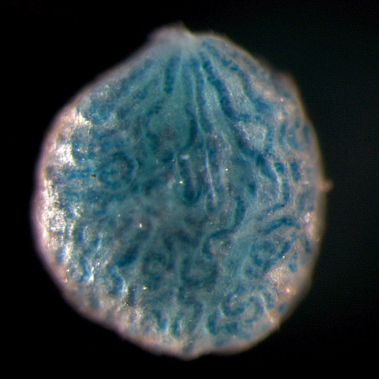 Figure 2: β-Gal staining of prospermatogonia, the non-dividing precursors to spermatogonial stem cells where de novo male-specific DNA methylation patterns are established.