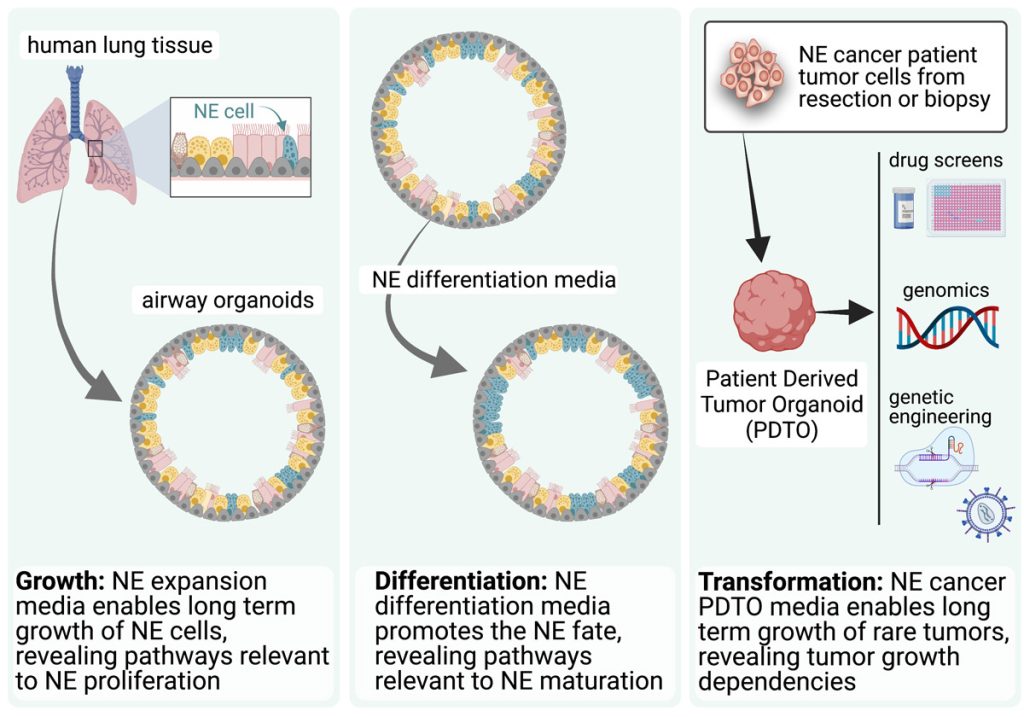 ingfographic showing the schematic of media impact on neuroendocrine lung organoids and tumor/neoplasm organoids