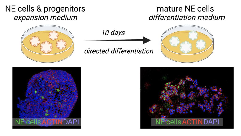 ingfographic showing IF staining for neuroendocrine cells in human lung/airway organoids after differentiation