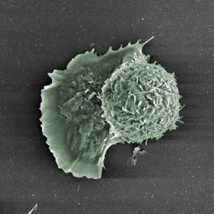 Figure 1: SEM image of a differentiating mouse embryonic stem cell, illustrating its highly variable surface topology.