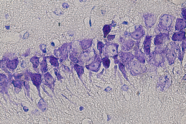 Thionin staining of hippocampal CA3 neurons.