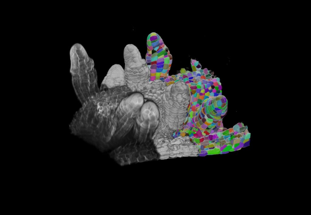 Figure 1: Microscopy provides imagery to the algorithm that then delineates the cellular structures, making the segmentation clearer.