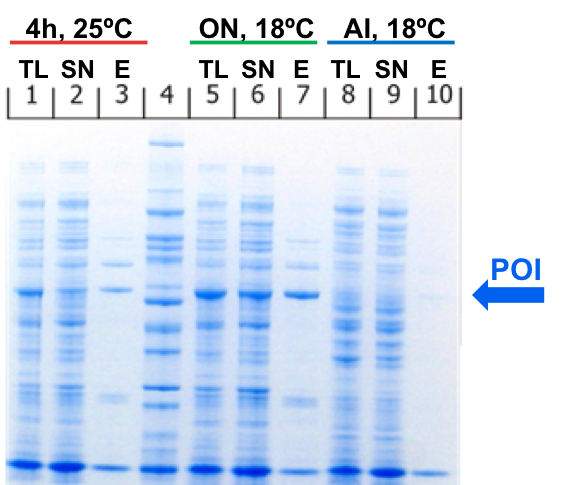 https://www.embl.org/groups/protein-expression-purification/wp-content/uploads/2021/05/Fig9_SDSPAGE_Ecoli_SmallScaleTest.png