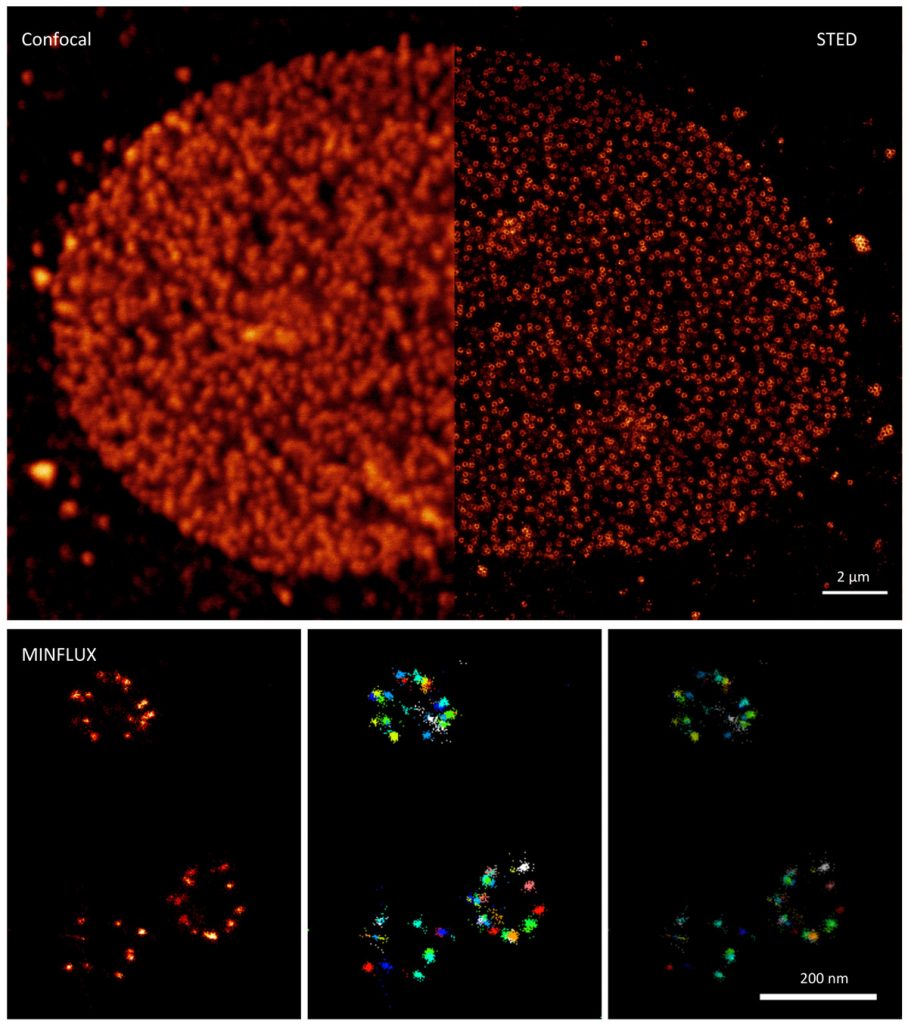 Fluorescently labeled nuclear pore proteins imaged by confocal microscopy, stimulated emission depletion (STED) microscopy and fluorophore coordinate detection by minimal emission fluxes (MINFLUX). For the MINFLUX images a different sample and label is shown. Credit: Sebastian Schnorrenberg/EMBL Imaging Centre.