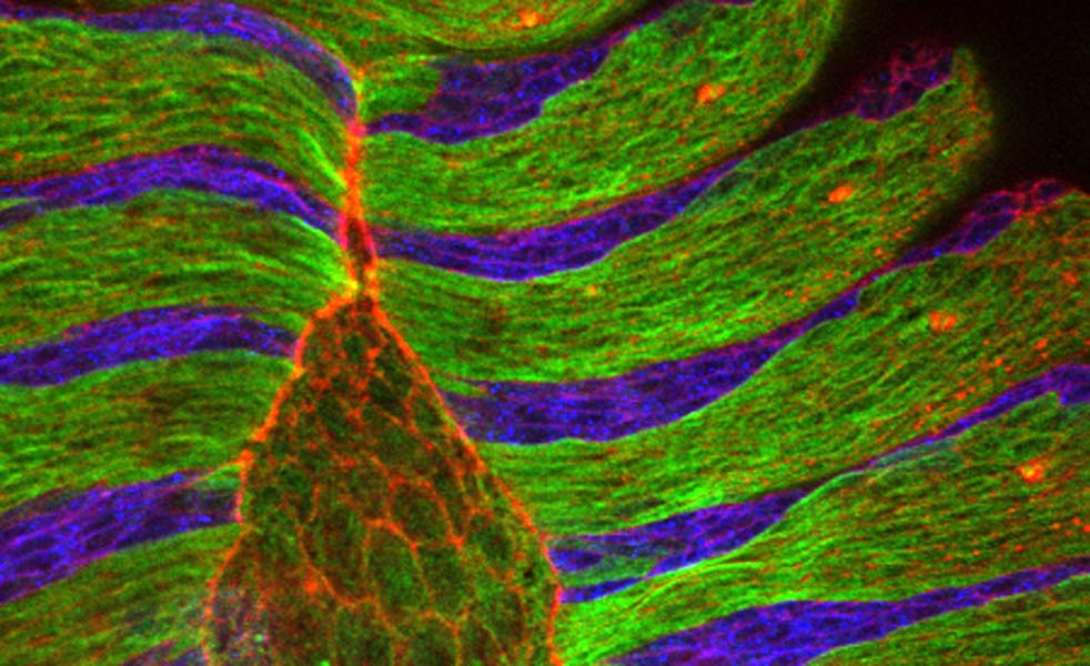 The microscope image of the dorsal closure of a fly embryo shows alternating stripes of epithelial cells with aligned microtubule bundles (green) and epithelial cells treated with a microtubule-destroying drug (blue). Labelled in red is the protein actin that lines the border of cells, particularly the amnioserosa cells occupying the eye-shaped opening.