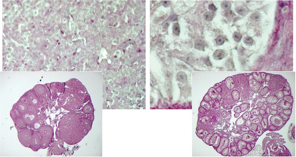 These microscopy images show the cellular reprogramming uncovered by EMBL scientists. On the left is an ovary of a normal adult female mouse, with a close-up (top left) showing the typical female granulosa cells. When the Foxl2 gene was silenced in these cells (right, top right: close-up), they took on the characteristics of Sertoli cells, the cells normally found in testes of male mice. Image credit: Treier / EMBL