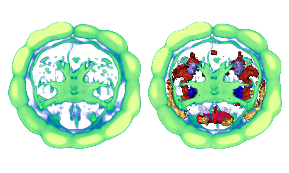 A virtual Platynereis brain (left), created by averaging microscopy images of the brains of 36 different individuals, onto which scientists mapped gene activity (right). Perspective shows the brain as viewed from inside a Platynereis larvae, at 48 hours' old. Image credits: EMBL/R. Tomer