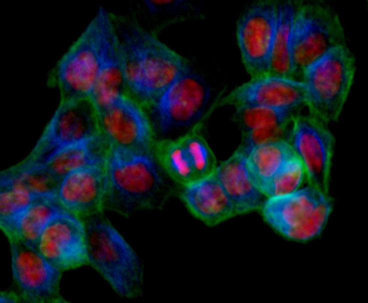 By silencing genes two at a time in cells like these, the scientists can analyse the genes’ combined effects. In this microscopy image of human cells, nuclei are shown in red, cell membranes in green, and the cellular scaffolding in blue.