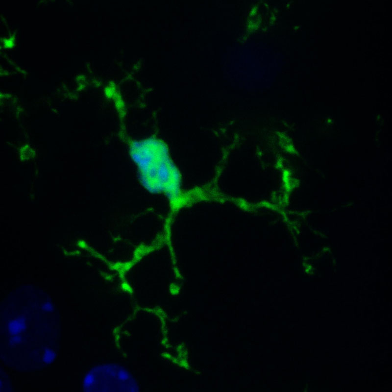 Microglia (green) in a mouse brain. The nuclei of all cells in the brain are labelled blue. Credit: EMBL/ R.Paolicelli