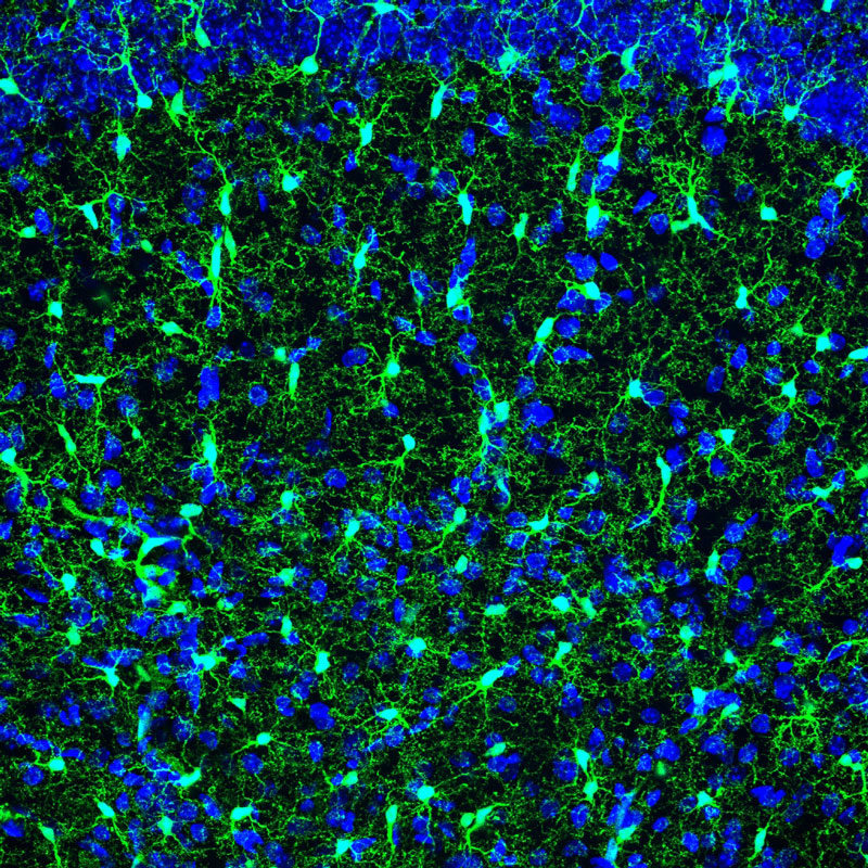 Microglia (green) in a mouse brain. The nuclei of all cells in the brain are labelled blue. Credit: EMBL/ R.Paolicelli