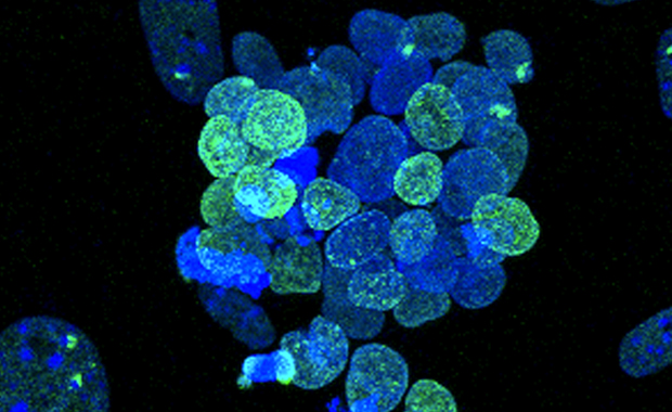 Major advance in stem-cell technology