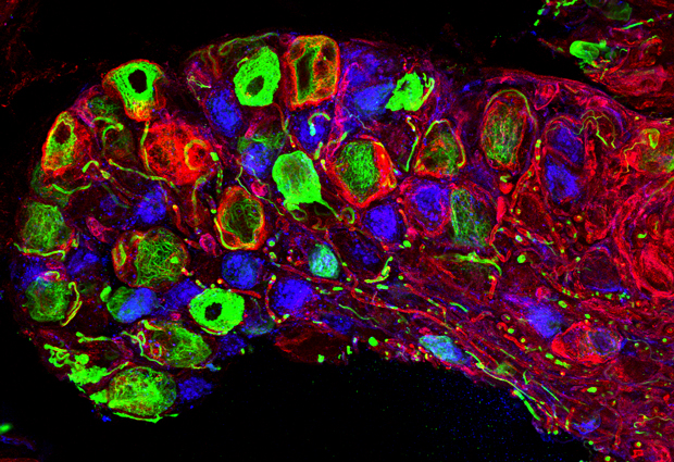 A bundle of nerves that relays information from touch receptors on the skin to the spinal cord and ultimately the brain, imaged with the new technique. IMAGE: EMBL/L.CASTALDI