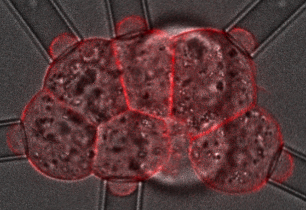 The scientists measured the force required to change the shape of the cells by gently deforming each cell with a pipette. IMAGE: J.L. Maitre/EMBL