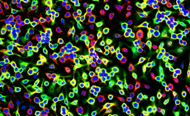 Fluorescence microscopy picture of bone marrow-derived macrophages (red: macrophage marker, blue: DNA, green: ferritin). Compared to the few control cells present in this picture, IRP-null macrophages express abnormally high levels of ferritin (green), which constitutes a pool of iron that Salmonella can exploit. IMAGE: Bruno Galy/DKFZ