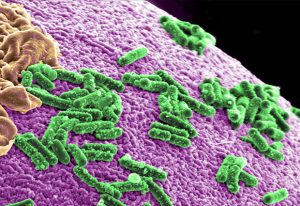 Gut bacteria are more affected by metformin than by the type-2 diabetes it is prescribed to treat. IMAGE: Courtesy of Pacific Northwest National Laboratory (BY-NC-SA)