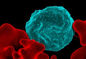 Colorised scanning electron micrograph of red blood cell infected with malaria parasites (blue); uninfected cells with a smooth red surface. IMAGE: (CC BY 2.0)