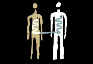 Illustration linking the guts of donor and recipient. IMAGE: Andrea Levy/The Plain Dealer