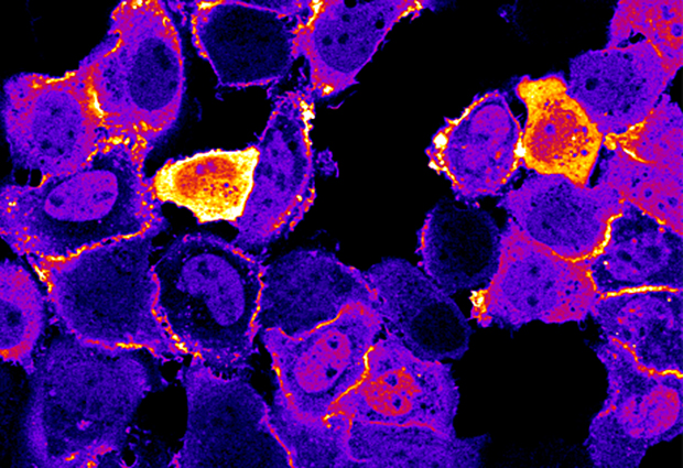 Photo-activatable fatty acids enable researchers to control the translocation of the enzyme protein kinase C from the cytoplasm to the cell membrane by means of light. IMAGE: D. Trauner