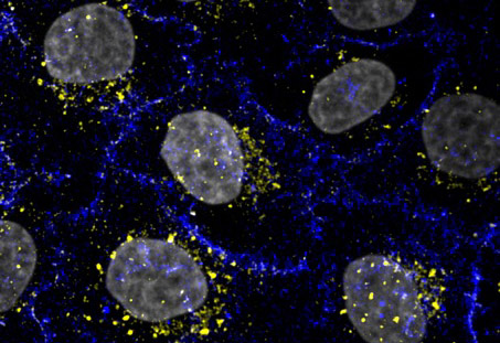 fluorescence image of receptor degredation