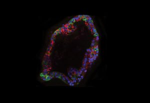 In organoid cultures, mouse residual breast cancer cells have elevated lipid metabolism (green). IMAGE: Jechlinger/EMBL