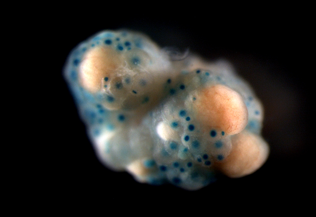 This mouse ovary and these immature eggs (in blue), can be used to study patterns of DNA methylation that affect only females.