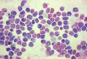 Plasmodium Gamete Formation