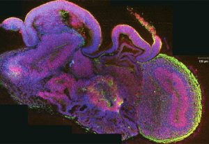 A section through an organoid stained for neurons in green, neural stem cells in red, and all cells in blue. IMAGE: IMBA/Madeline Lancaster