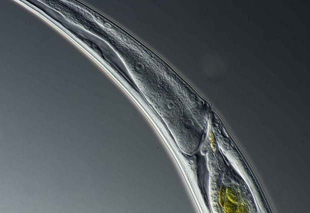 C. Elegans microscopy