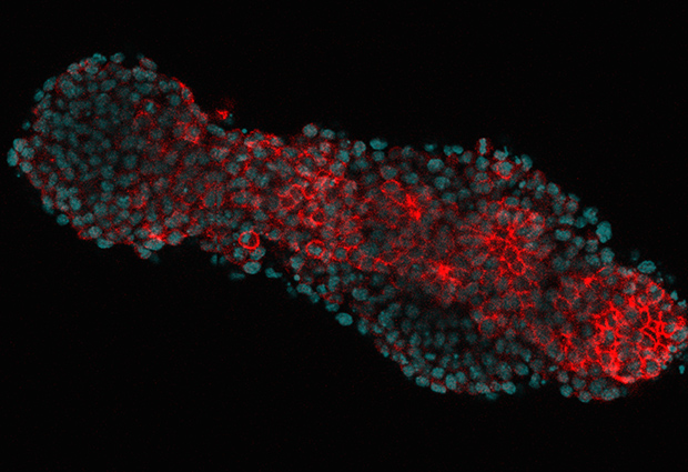 Optical section of a ‘gastruloid’ – an embryonic organoid made from mouse embryonic stem cells and stained for E-Cadherin (red), marking cell outlines and nuclei (blue). IMAGE: Vikas Trivedi/EMBL
