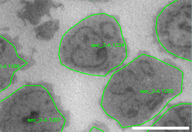 An example virtual map of individual leukaemia cells on a resin section, detected automatically using SerialEM and py-EM.