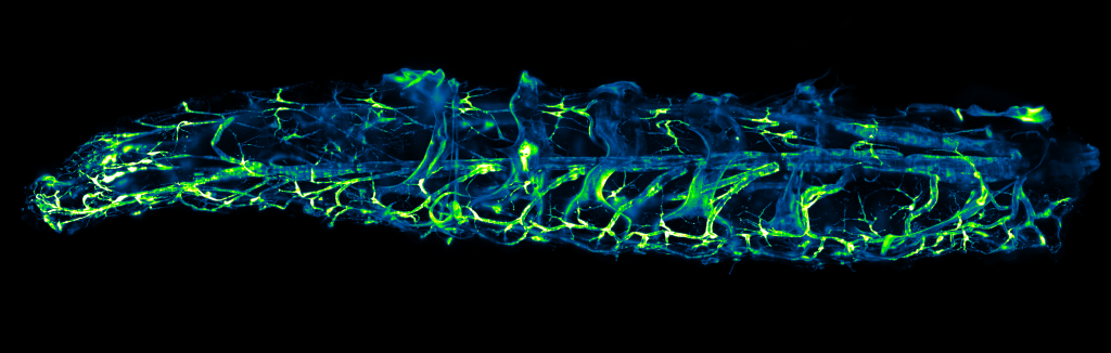Microscopy image of a fruit fly larva’s developing tracheal system