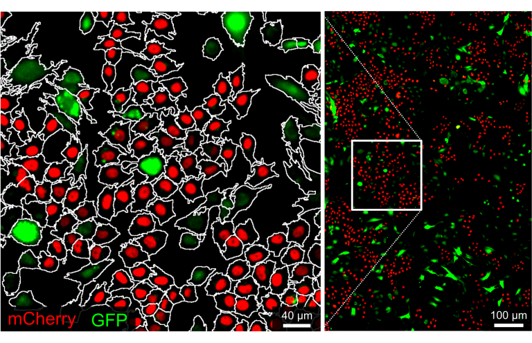 A cluster of cells are coloured according to the predominant metabolite inside them. Here, a lone green cell is surrounded by red ones with more greens visible at the edges of the image.