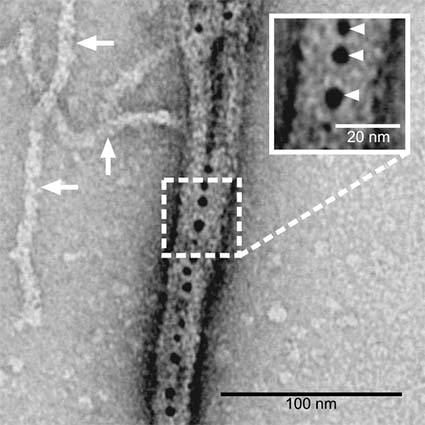 Electron micrograph showing actin fibres alone or bound by Bottleneck