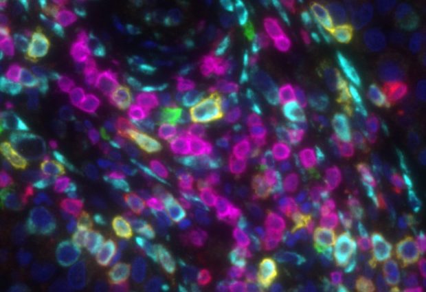 Using multiplex-immunostaining to characterise B cells. PHOTO: Christine Wagner