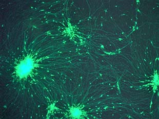 Human neutrons