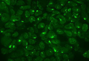 SPEN protein (green) in living cells. Credit: François Dossin