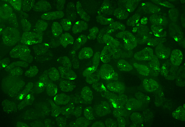 SPEN protein (green) in living cells. Credit: François Dossin