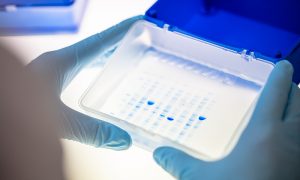 Purified proteins on an SDS-polyacrylamide gel