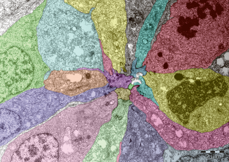 Patchwork-like image of developing zebrafish sensory organ. Picture credits: Virginie Lecaudey / EMBL.