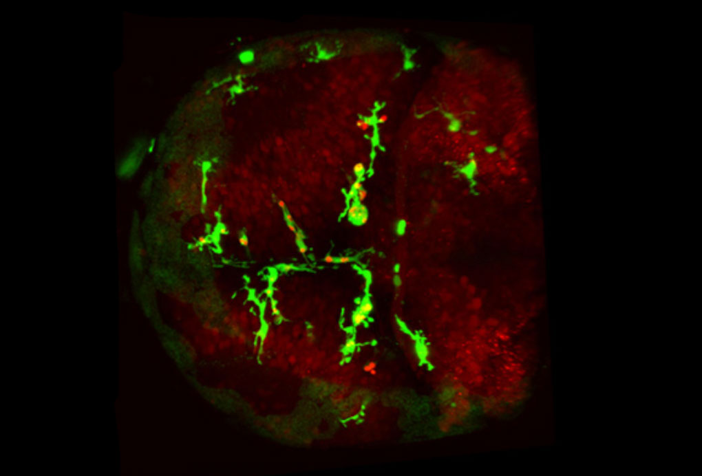 Microglial cells