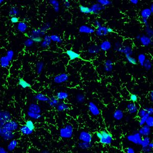 Microglia (green) in a mouse brain. The nuclei of all cells in the brain are labelled blue. Credit: EMBL/ R.Paolicelli