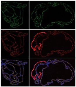 These microscopy images show that a protein from the NSL complex (green) and MOF (red) both bind to all chromosomes in male (right) and female (left) fruit flies - overlap is shown in purple. On the male X chromosome, MOF binds not only to promoter regions but also to the body of the genes, generating a brighter signal (pink). Image credits: Akhtar/EMBL.