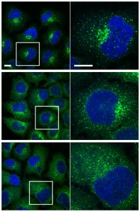 Silenced genes in a cell