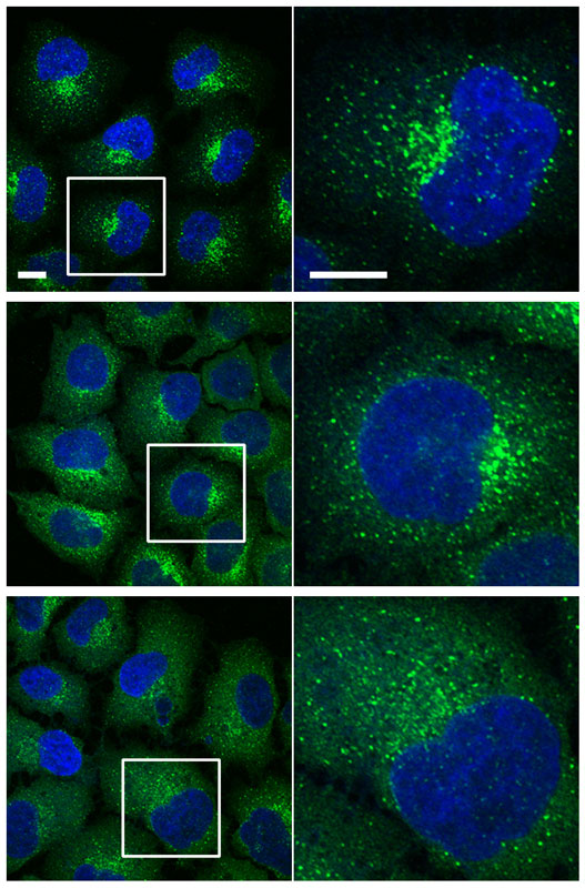 Silenced genes in a cell